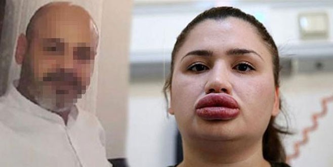 Estetikçi kuaföre kötü haber!