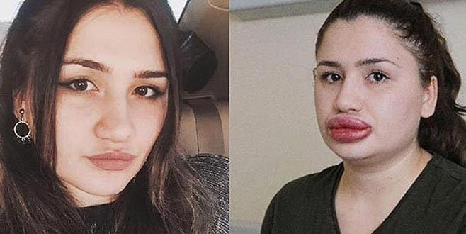 Cezaevinden kaçan ‘sahte estetikçi’ yakalandı!