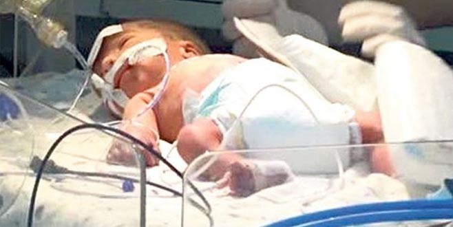 Annesi ölen bebek 87 gündür yaşam savaşı veriyor