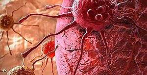 İşte kanserin 10 belirtisi