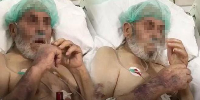 Yoğun bakımda skandal görüntüler