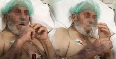 Yoğun bakımda skandal görüntüler