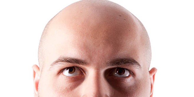 Bilim insanları kelliğe çare buldu