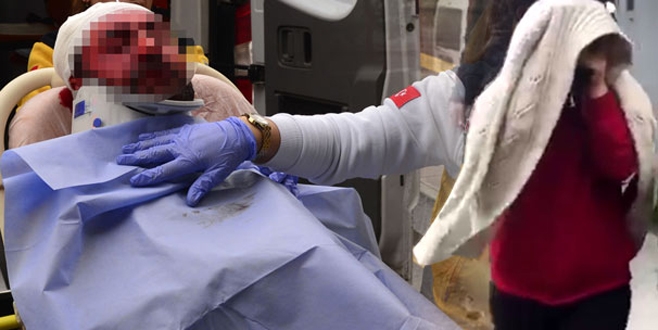 Eski eş kocasını bu hale getirdi