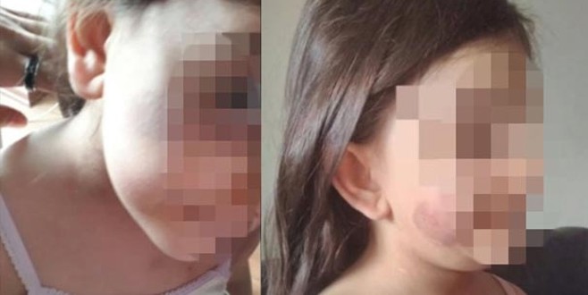 5 yaşındaki Sahra’ya eziyet davasında karar