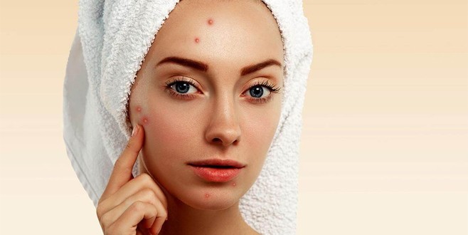 Aknelere kesin çözüm!