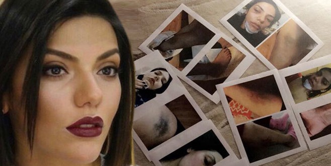 Eda Pera Küçük Haluk Levent’ten yardım istedi