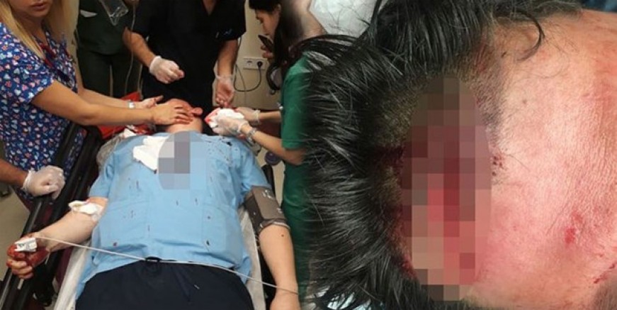 Doktora parke taşıyla çirkin saldırı