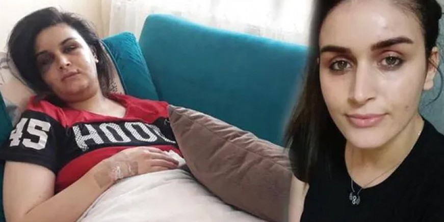 Boşanmak isteyen eşe görülmemiş işkence!