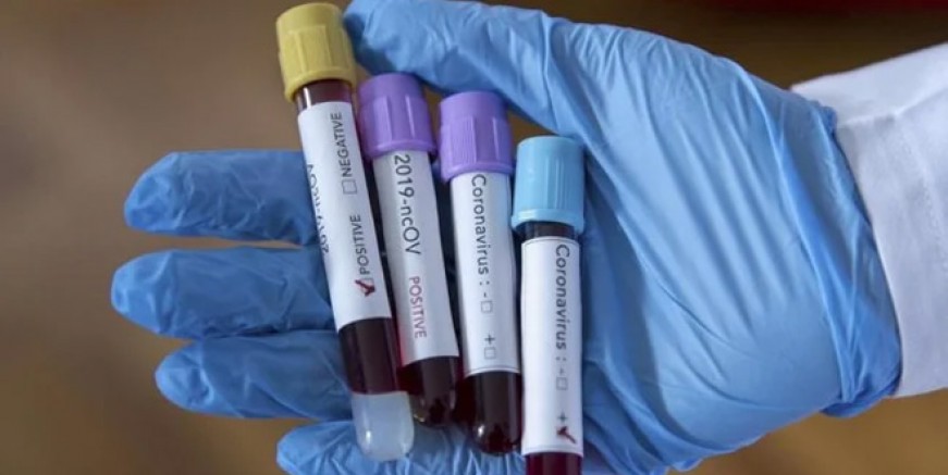 Coronavirüs’te korkunç rakam; 21 milyon