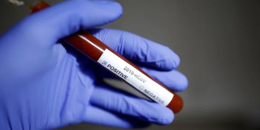 Coronaviruste can kaybı 1 milyona dayandı!