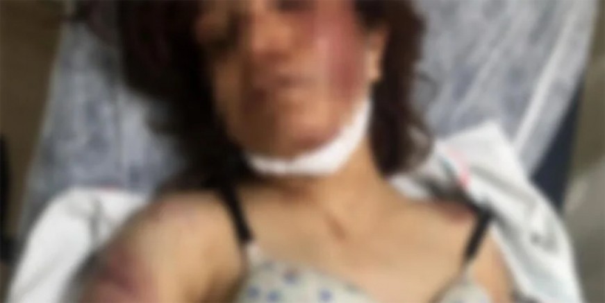 Böyle zalimlik görülmedi; eşinin tırnaklarını çekti