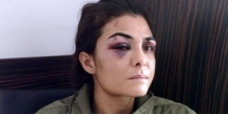 Melek İpek yine yürekleri dağladı!