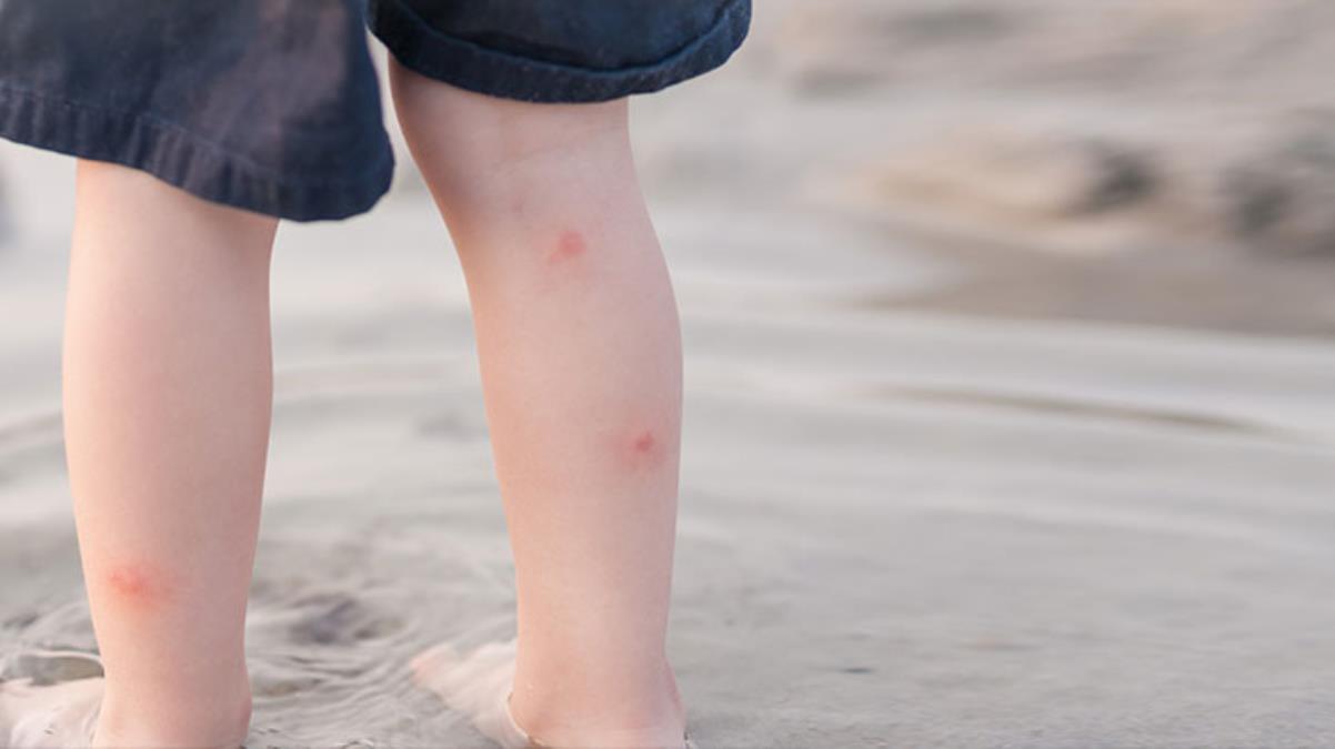 İstanbul’da sivrisinek paniği büyüyor!