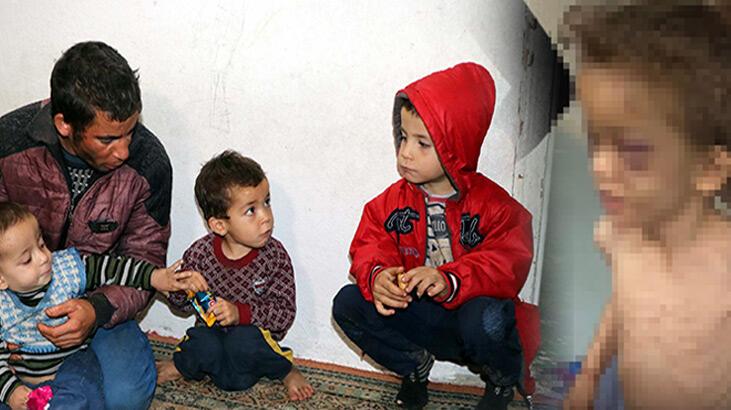 Gaziantep’te 5 yaşındaki çocuğa işkence!