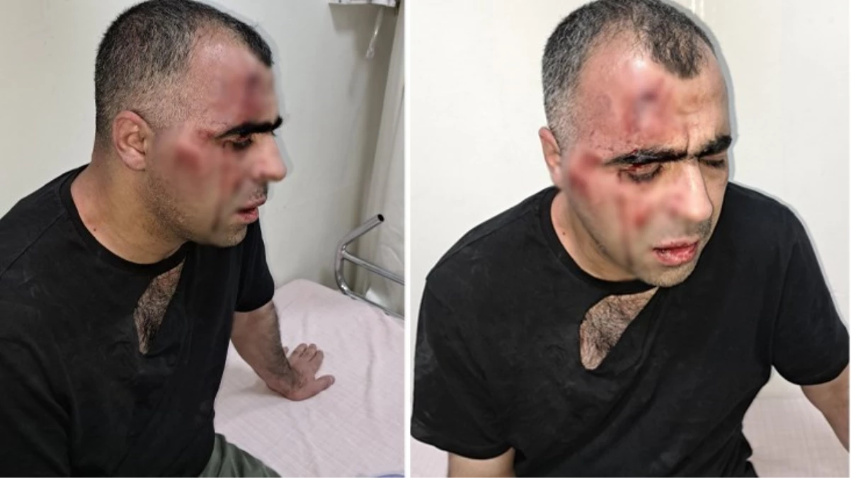 Gazeteci Sinan Aygül’ün darp edilmesiyle ilgili soruşturma