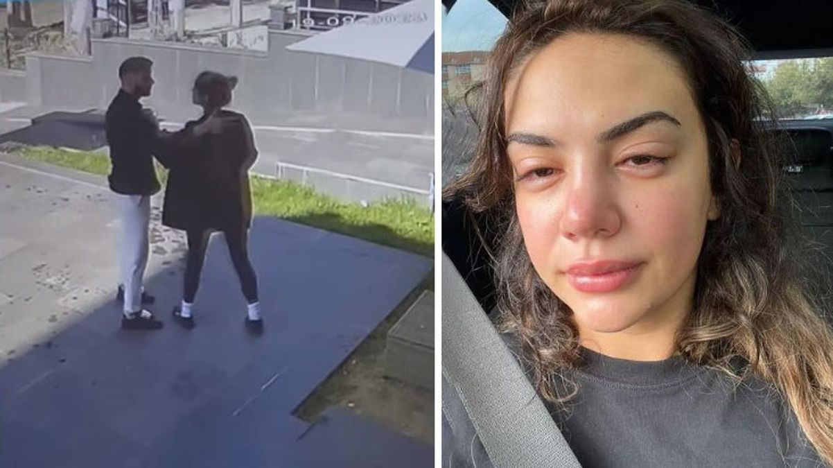 Eski eşinden şiddet gördüğünü söyleyen şarkıcı Ece Ronay yardım feryadı