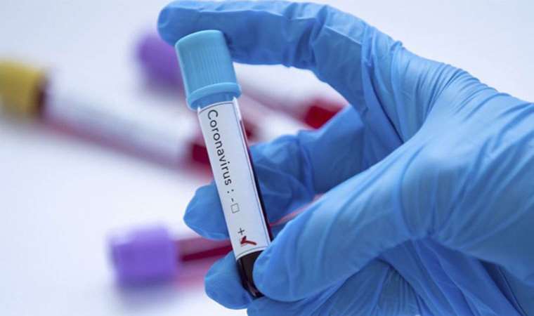 Bilim Kurulu üyesinden Covid-19 uyarısı