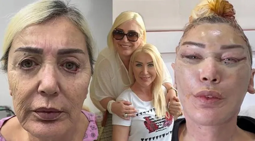 Seda Sayan’ın ablası estetik operasyonu geçirdi