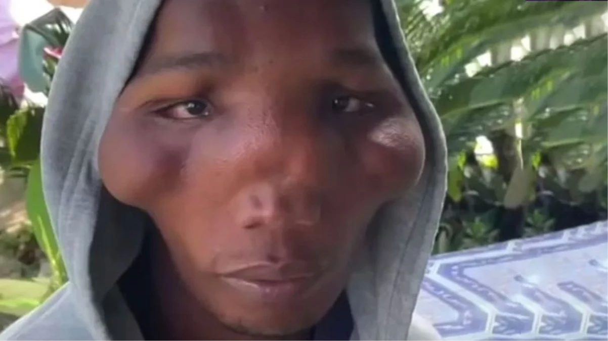 Üçgen yüzlü ailenin hastalığındaki gizem çözülemiyor