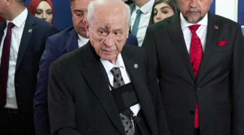 Bahçeli’nin yüzündeki morlukların nedeni belli oldu