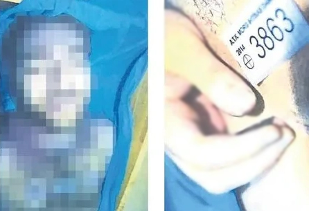 İşte Cem Garipoğlu’nun otopsi raporu