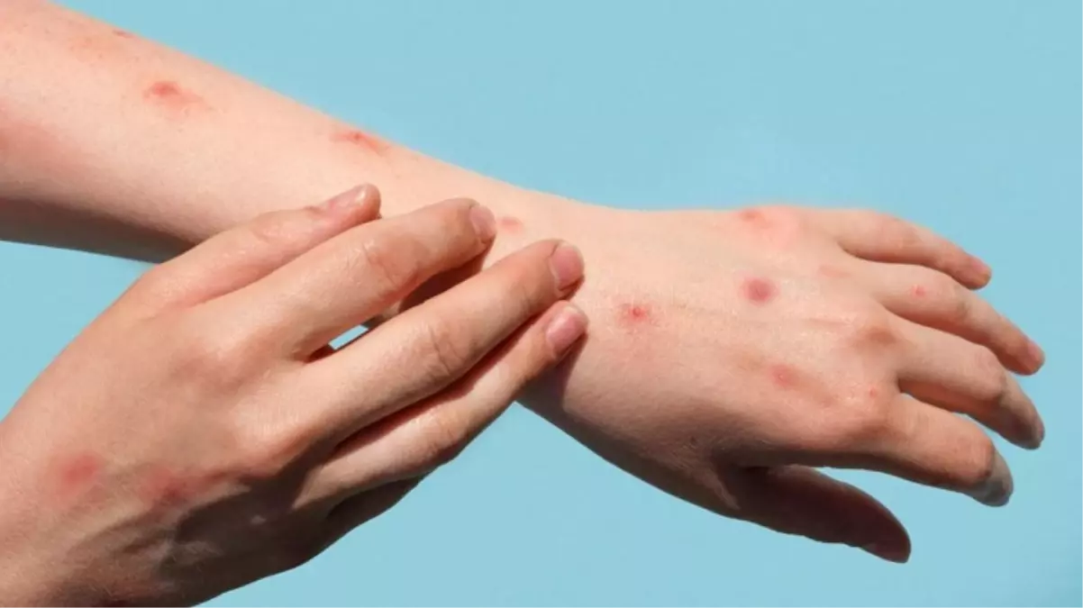 İşte maymun çiçeği ile ilgili merak edilenler