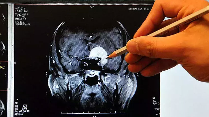 Kahve severler dikkat: 3 bardaktan fazla kahve…