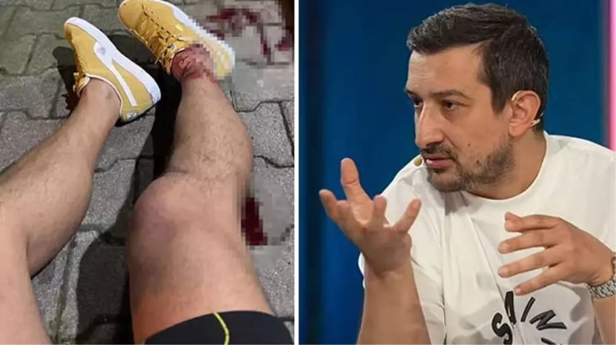Serhat Akın’a saldırıdaki tüm şüpheliler yakalandı