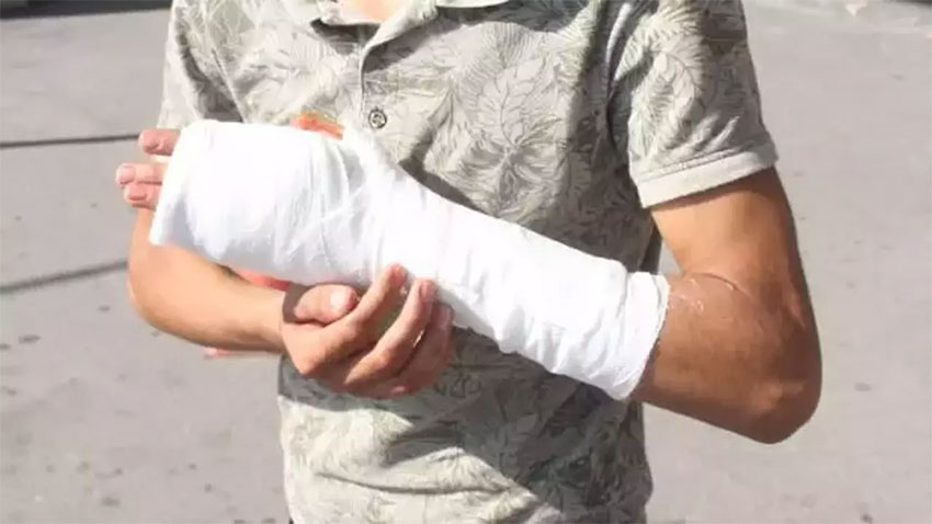 Acil servisler acemi kasaplarla doldu